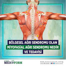 Halbuki fibromiyalji sendromunda ağrı daha yaygındır, myofasial ağrı sendromu miyofasial ağrı sendromlarında öykü ve fizik muayene tanı koydurucudur. Mediform Batman Bir Veya Birkac Kas Grubunda Gorulen Agri Hassasiyet Ve Tutuklukla Karakterize Bir Hastaliktir Halkimiz Tarafindan Kulunc Kas Romatizmasi Ve Yel Vurmasi Gibi Isimlerle Adlandirilir Fibromiyalji Sendromu Ile Cogunlukla