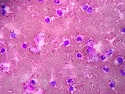 Peel a translucent piece of tissue from the onion. Human Blood Cells Under Microscope View Stock Photo Picture And Royalty Free Image Image 81293536