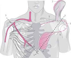 The pectoralis major muscle is a powerful adductor of the arm, and also assists in internal rotation and flexion at the shoulder joint. Pectoralis Major Island Flap Facial Plastic Surgery