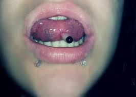 Zungenpiercing Unter Der Zunge Entzundet Piercing Entzundung