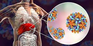 Check spelling or type a new query. Apakah Penyakit Hepatitis Menular Halaman All Kompas Com