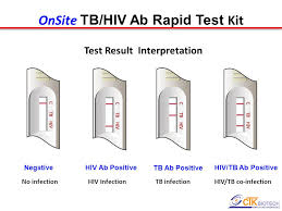 Onsite Tb Hiv Ab Rapid Test 2 In 1 Test Kit Ppt Video Online Download