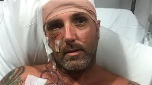 Port Douglas coconut harvester Daniel Fear returns to Rusty Markets after  fall