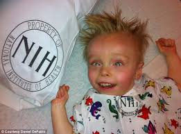 Terminal copper deficiency Menkes film unites families