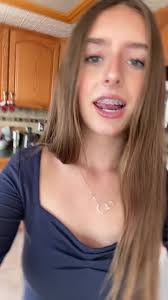 Amanda with No Braces