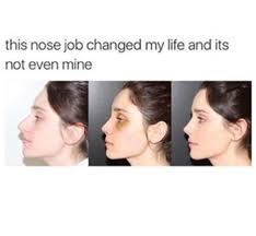 Pin By Ari On Memes More Nose Job Rhinoplasty Nose Jobs Acne On Nose