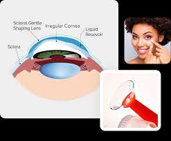 Image result for Sclera