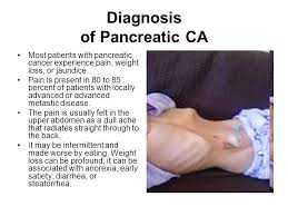 It's usually caught only when it becomes large and spreads outside of the gland. Final Diagnosis Pancreatic Cancer Pancreatic Cancer It Is A Malignant Neoplasm Of The Pancreas The Prognosis Is Generally Poor Less Than 5 Percent Ppt Download