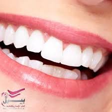 تفتيح اللثة بالليزر تجعل اللثة أكثر صحة وتعيدها إلى لونها الطبيعي الجميل خلال جلسة أو جلستين فقط