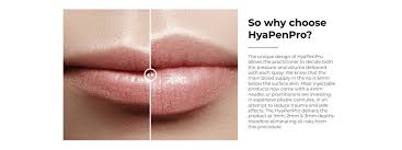 When you need a smart, dependable contractor or plumber, count on our team of independent professionals for your heating, cooling and water heating needs. Hyapenpro Royal Pink Oy