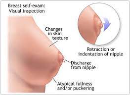 Breast cancers may spread to other areas of the body and trigger other symptoms. Breast Cancer Symptoms Modern Cancer Hospital Guangzhou China
