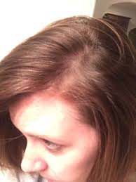 And this causes several consequences, post. Ot Post Baby Hair Changes 2 Years Later May 2014 Babies Forums What To Expect