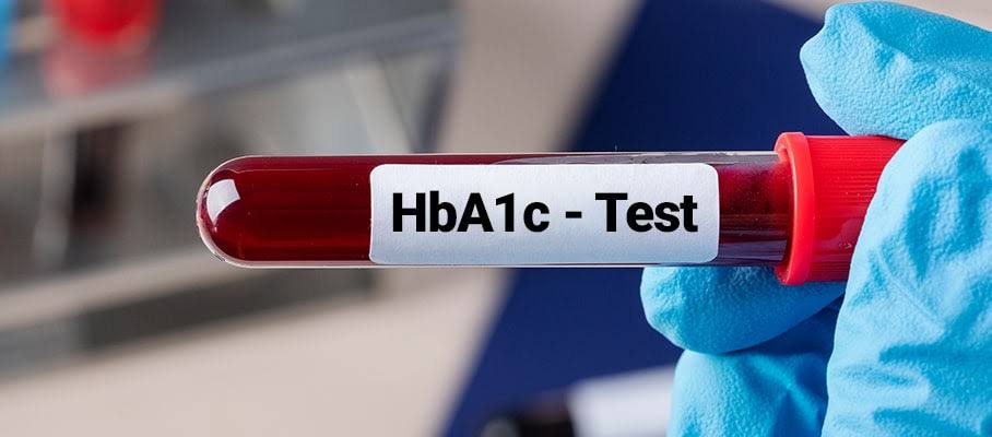 HBA1C product image