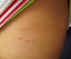 Image result for Fipronil kill insects
