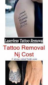 Pin On Tattoo Removal