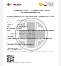 Hasil Uji Swab Pcr Sudah Keluar Paslon Berseri Dinyatakan Negatif
