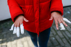 Girl 13 Is Left In Agony After Having Her Fingernails Torn Off In Racist Attack Daily Mail Online Even their hormones are changing in preparation for puberty so changes in attitude may also be expected. girl 13 is left in agony after having