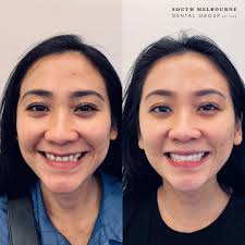 South Melbourne Dental Group