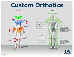 Image result for Functional Leg Length Discrepancy