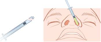 Download domino rp apk for your android phone and enjoy unlimited rp coins on your phone. Diced Costal Cartilage Graft Combined With Muscle Repositioning Improves Cleft Side Alar Asymmetry In Asian Secondary Unilateral Cleft Rhinoplasty A Three Dimensional Evaluation Journal Of Plastic Reconstructive Aesthetic Surgery