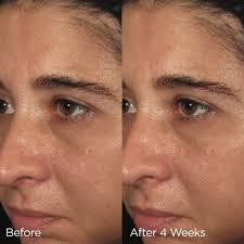 ORMEDIC balancing biopeptide crème