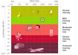 Audiogram Picture Of An Audiogram Explained Audiology