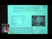 Resultado de imagen para site:www.youtube.com "reparación de la válvula mitral"