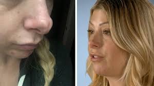 Jennifer Wants Her Jurassic Schnoz Fixed