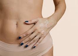 We did not find results for: 10 Things I Wish I Knew Before My Tummy Tuck Realself News