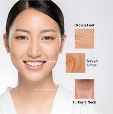 The revlite laser treatment at coco skin laser health is an effective procedure for blackheads, enlarged pores, fine lines, melasma, mild acne, pigmentation, radiation tattoos. Photoacoustic Laser Treatment Face On Clinic