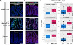 p53 terminates the regenerative fetal-like state after colitis-associated  injury | Science Advances