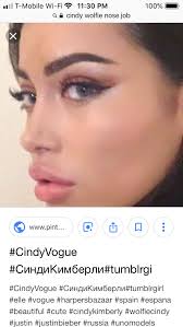 Pin By Hailey On Nose Lip Job Inspo Nose Job Lip Job Nose