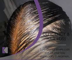 Basic and specific (basp) classification for pattern hair loss (from: Facebook