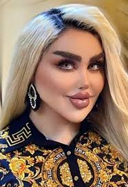Jessica Alves underwent her first cosmetic procedure when she was just  17-years-old and since then she has spent over a million pounds morphing  herself into a Human Barbie Doll.