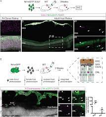 We did not find results for: Transplantation Of Photoreceptors Into The Degenerative Retina Current State And Future Perspectives Sciencedirect