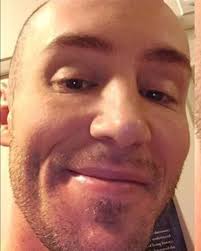 Observed Impulse: Myofascial Release for the Face: Composure, Aesthetics  and Mental Health