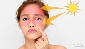 12 thành phần làm trắng da thường được dùng trong mỹ phẩm