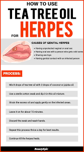 Pin On Home Remedies