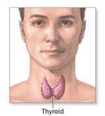 One of the most common signs of thyroid cancer in women is a goiter.a goiter is swelling of the thyroid gland that is evident because of a lump that develops in the affected woman's neck. Life After Hypothyroidism Endhypothyroid Profile Pinterest