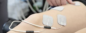 Image result for Electrical Stimulation Therapy