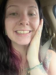 How to whiten naturally yellow teeth?