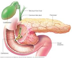 You may not need treatment if you do not have signs or symptoms. Pancreatitis Caused By Gallstones Mayo Clinic