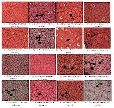 Image result for Englerina