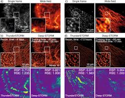 Later roman and medieval studies, subaquatic. Democratising Deep Learning For Microscopy With Zerocostdl4mic Nature Communications