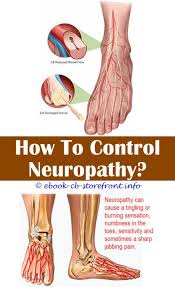 14 Majestic Neuropathy Treatment Watches Ideas Diabetic Neuropathy Peripheral Neuropathy Neuropathy