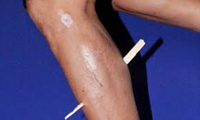 Enjoy watching & don't forget to subscribe. Cyclist Azizulhasni Awang Leg Skewered By Shard Of Wood But He Finishes Race Daily Mail Online