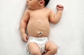 Also, the stump will dry and heal much faster if you expose it to air as much as after the cord stump has fallen off, keep the area clean and dry until the area heals completely. Umbilical Cord Care Madeformums