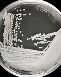 Image result for Buchnera candida