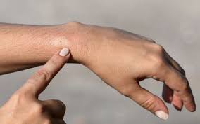 Without knowing too much about this topic, i would say. How To Detect An Allergen And Remove It From Your Home