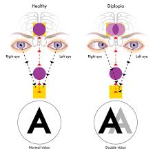 Vision Loss In One Eye: Causes Of Blurry, Dark, Or Partial Vision
